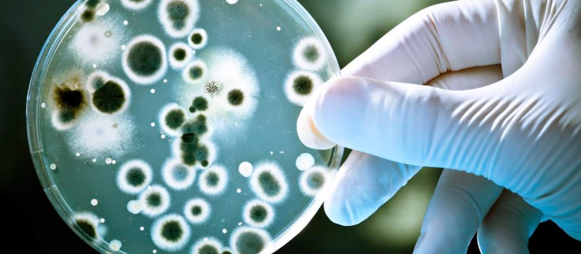 Bacteria-Petri-Dish-Science-Lab.jpg