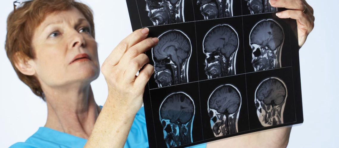 Doctor-Looking-A-X-Ray-Ct-Scan-Brain.jpg