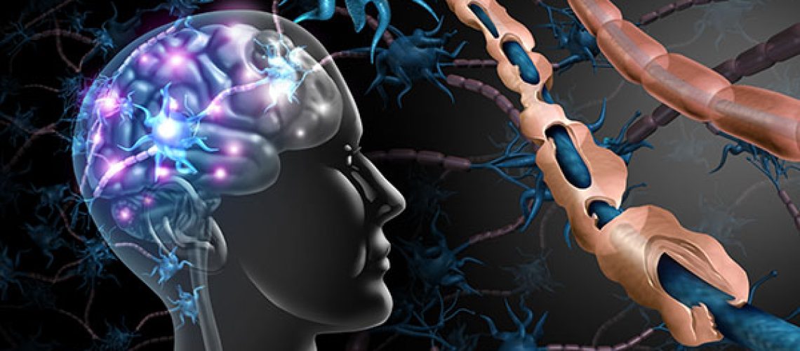Multiple-Sclerosis-Nerve-Disorder-1.jpeg Multiple-Sclerosis-Nerve-Disorder-1.jpeg