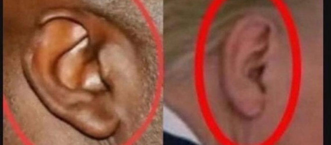 TRUMP-EAR-1.jpeg