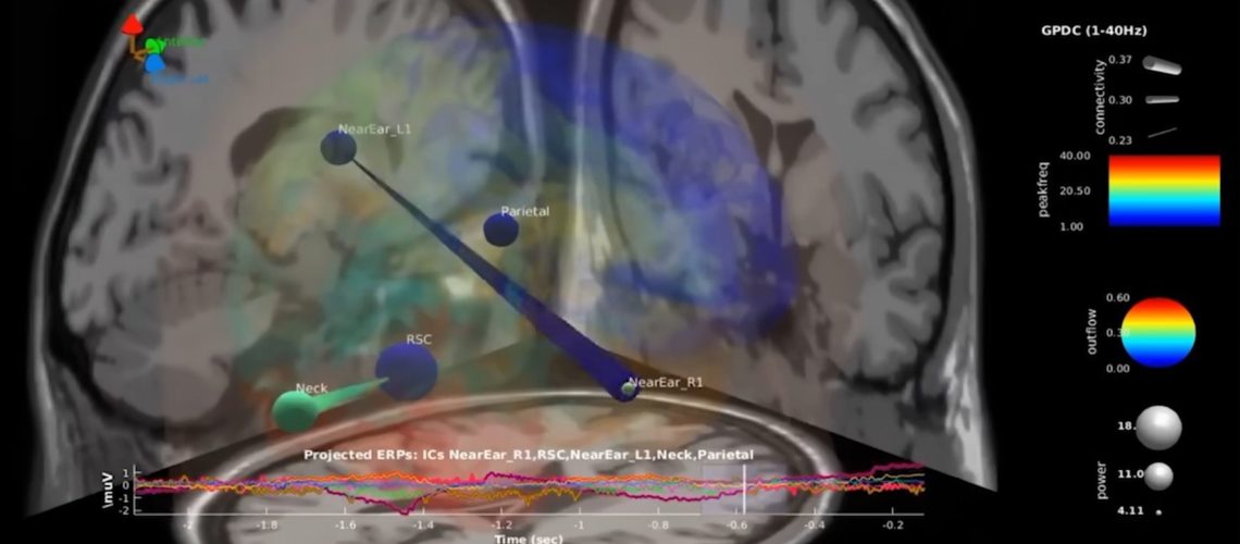 eeg-brain-waves.jpg