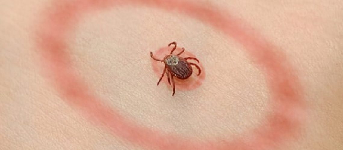 lyme-tick-stock.jpg
